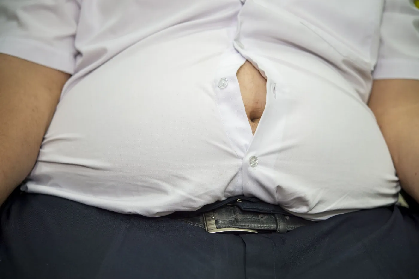 punca-obesiti-di-malaysia