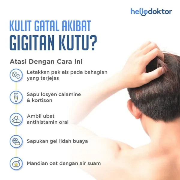 ubat kutu kucing