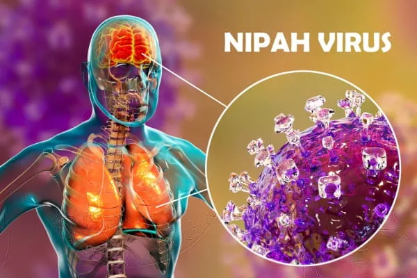 virus nipah di Malaysia