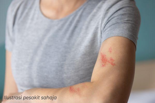 tanda kencing manis saraf 