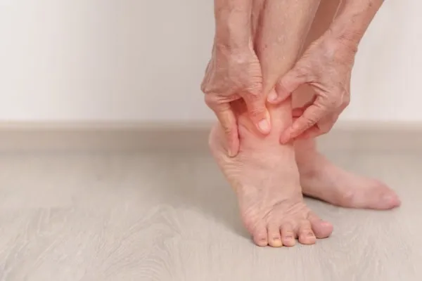 makanan penyebab gout