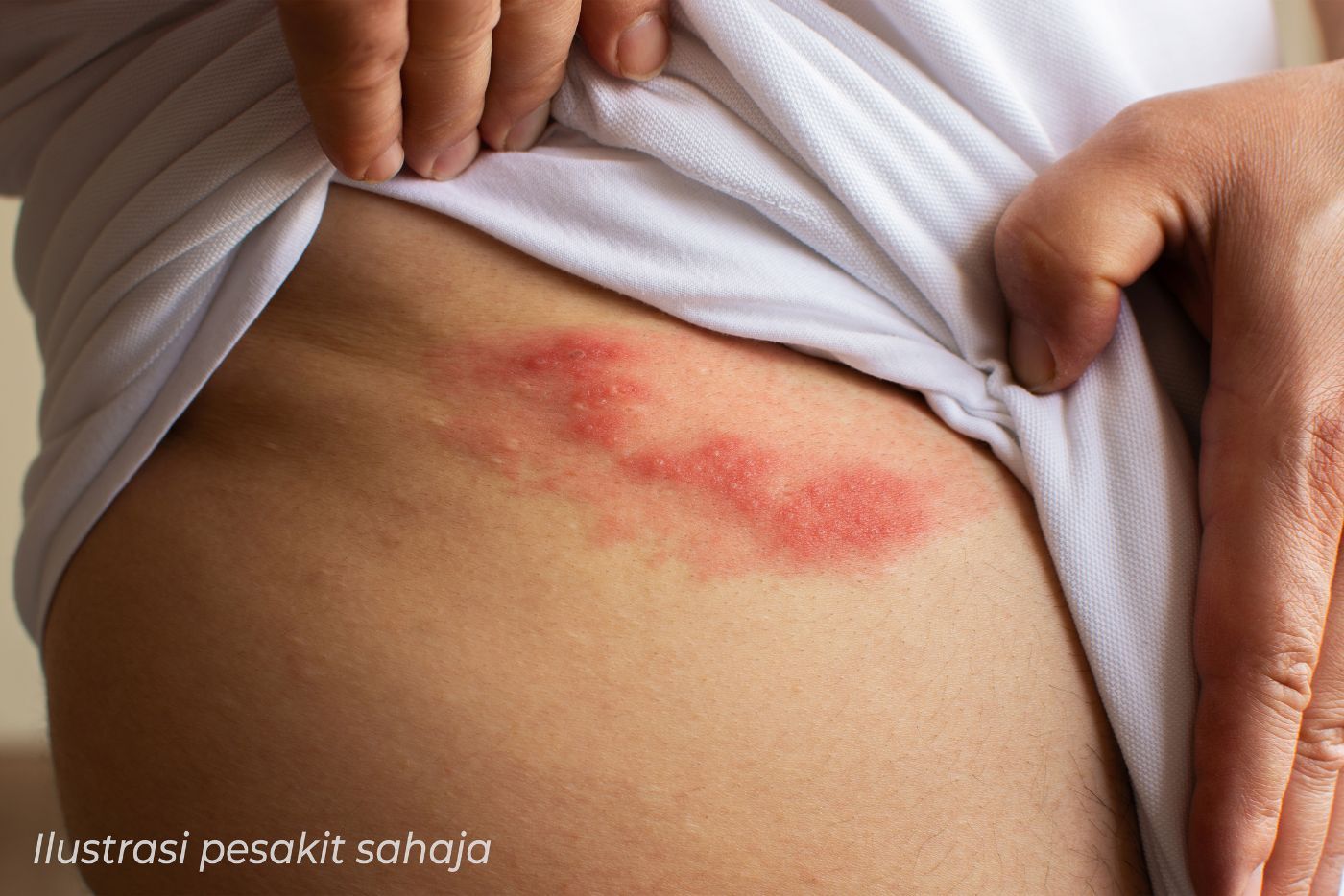 Kayap Dan Kencing Manis Ketika Umur 50 Tahun: Apa Yang Anda Perlu Tahu