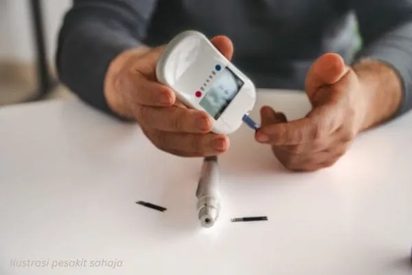 risiko penyebab kayap