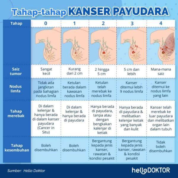 kanser payudara tahap 3
