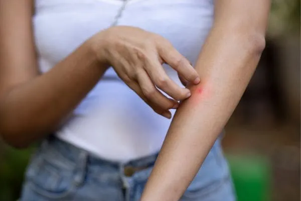 nyamuk malaria