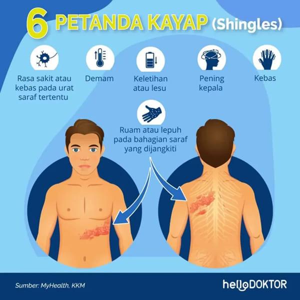 kencing manis