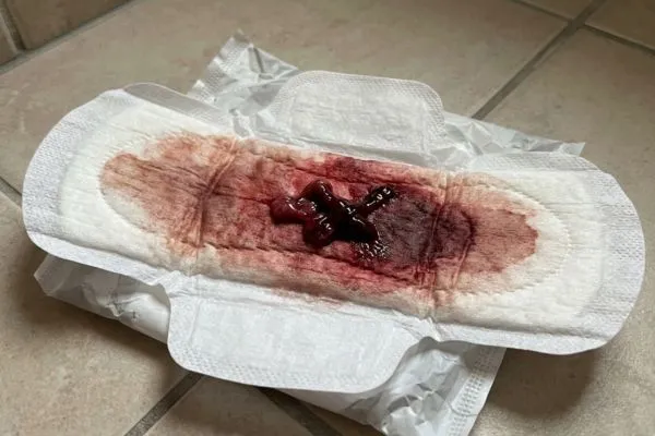 kenapa darah haid berketul